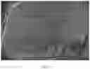 Fig. 16 - Composite scaffold for the repair, reconstruction, and regeneration of soft tissues