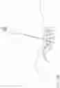 Fig. 17 - Method and apparatus for minimally invasive insertion of intervertebral implants