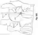 Fig. 56 - Method and apparatus for minimally invasive insertion of intervertebral implants