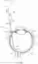 Fig. 04 - Retinal patch graft and biopsy device
