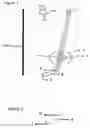 Fig. 02 - Tracheal intubation facilitator with superior ventilating capability