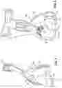 Fig. 02 - Method and apparatus for managing moisture buildup in pressurised breathing systems