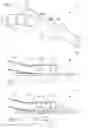 Fig. 02 - Nasal cannula with flow restrictor