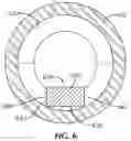 Fig. 06 - Guide extension catheter