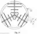 Fig. 10 - HEART CATHETER