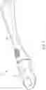 Fig. 02 - Caulking finger