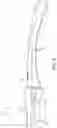 Fig. 07 - Caulking finger