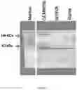 Fig. 02 - Bacterial strain clostridium histolyticum and methods of use thereof