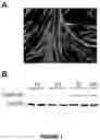 Fig. 02 - Compositions and methods for modulating dysferlin expression