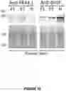Fig. 12 - Compositions and methods for modulating dysferlin expression
