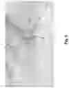 Fig. 06 - Hidden fastener assembly for attaching grooved deck members