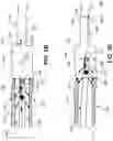 Fig. 06 - Traversing across a wash-out zone in a wellbore