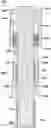 Fig. 01 - Polished rod liner assembly