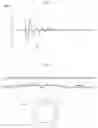 Fig. 02 - Detection of the direction of rotation of a vehicle engine