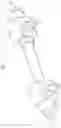 Fig. 02 - Rail for high-pressure direct injection
