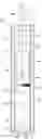 Fig. 01 - Shock absorber