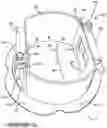 Fig. 11 - Lighting arrangement with battery backup