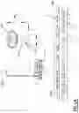 Fig. 05 - Moveable lens luminaire