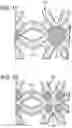 Fig. 14 - Recoil pad for a firearm