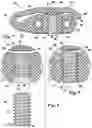 Fig. 04 - Retention clip