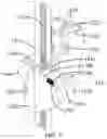 Fig. 09 - Bracket apparatus