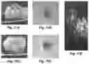 Fig. 09 - Interferometric method and apparatus for non-invasive assessment of oocyte maturity and competency
