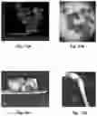 Fig. 10 - Interferometric method and apparatus for non-invasive assessment of oocyte maturity and competency