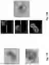 Fig. 11 - Interferometric method and apparatus for non-invasive assessment of oocyte maturity and competency