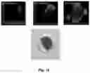 Fig. 12 - Interferometric method and apparatus for non-invasive assessment of oocyte maturity and competency
