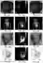Fig. 17 - System and method for cabinet x-ray systems with near-infrared optical system