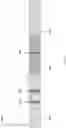 Fig. 04 - Lateral flow immunoassay for measuring functional C1-esterase inhibitor (C1-INH) in plasma samples