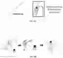 Fig. 11 - Lateral flow immunoassay for measuring functional C1-esterase inhibitor (C1-INH) in plasma samples