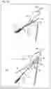 Fig. 10 - INSECT CATCHING TOOL