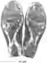Fig. 20 - HYDROGEL TIE LAYER
