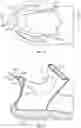 Fig. 08 - Footwear heel spring device