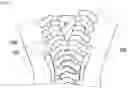 Fig. 06 - Slide fastener
