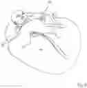 Fig. 10 - Childcare article of the baby bedding type