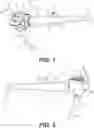 Fig. 02 - Chambered handle for a medical device