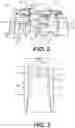 Fig. 03 - Systems and devices for articulation wire guidance