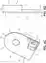 Fig. 05 - Systems and devices for articulation wire guidance