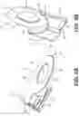 Fig. 10 - Systems and devices for articulation wire guidance
