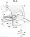 Fig. 08 - Endoscope