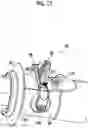 Fig. 13 - Endoscope