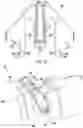 Fig. 15 - Endoscope