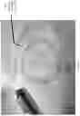Fig. 10 - Devices, systems, and methods for advancing and positioning tethered capsule microendoscopes