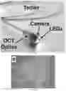 Fig. 12 - Devices, systems, and methods for advancing and positioning tethered capsule microendoscopes