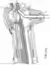 Fig. 10 - Endoscope for imaging in nonvisible light