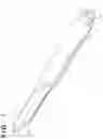 Fig. 02 - Expanding endoscope and method