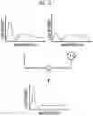 Fig. 14 - Endoscope system and method of operating the same