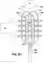 Fig. 04 - Mapping grid with high density electrode array